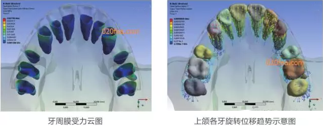 有限元分析法在结构、医学、流体与热及电场的分析与应用