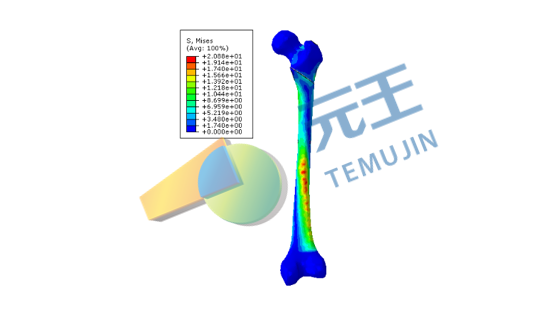 关节有限元分析